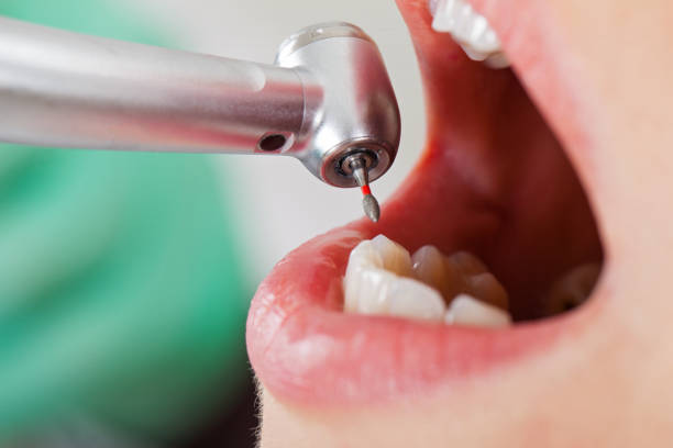 Best Emergency Root Canal Therapy in Douglas, AL
